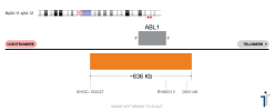 ABL1 FISH Probe