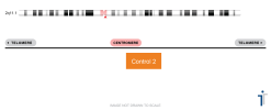 Alternative view of Chromosome 02 Control FISH Probe