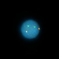 Alternative view of IGH/MALT1 SPLIT FISH Probe
