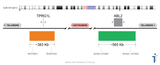 TPRG1L/ABL2 FISH Probe