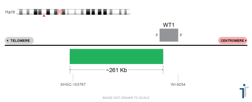 WT1/EWSR1 FISH Probe
