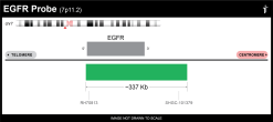 Alternative view of MCL1/EGFR/MYC/P16 FISH Probe